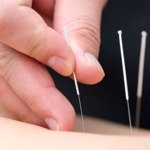 Traditional Acupuncture Diploma - 6 Months - Carlisle
