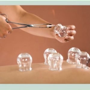 Dry / Fire Cupping - Manchester