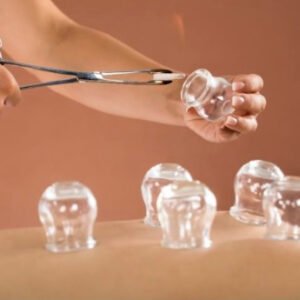 Dry / Fire Cupping - Wales